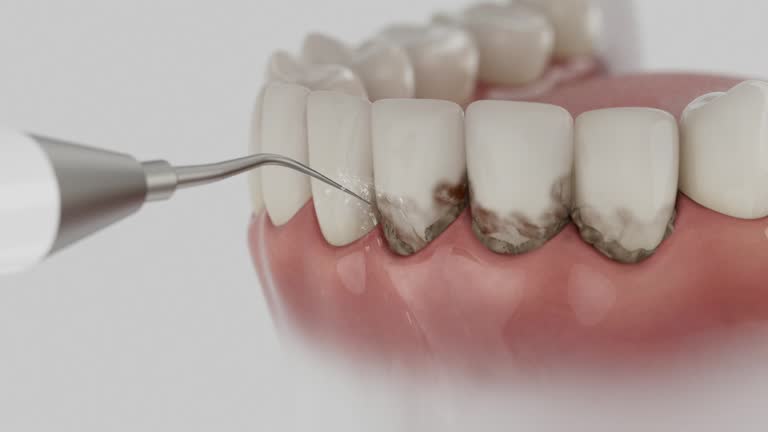 Trusted Dental Implants service in Gallatin, MO - Dentist Open Now